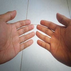 My hands that care for people